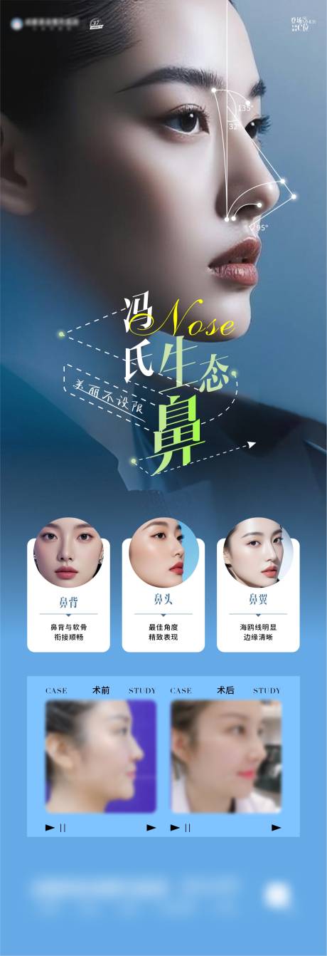 源文件下載【享設(shè)計】搜索編號：56740032483648715【鼻部填充整形美學海報】