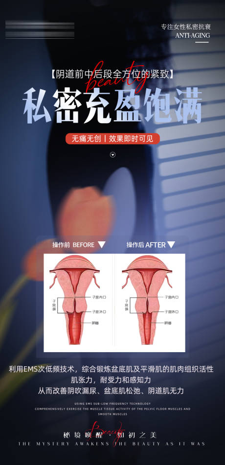 源文件下載【享設計】搜索編號：70930032462309100【私密抗衰緊致海報】