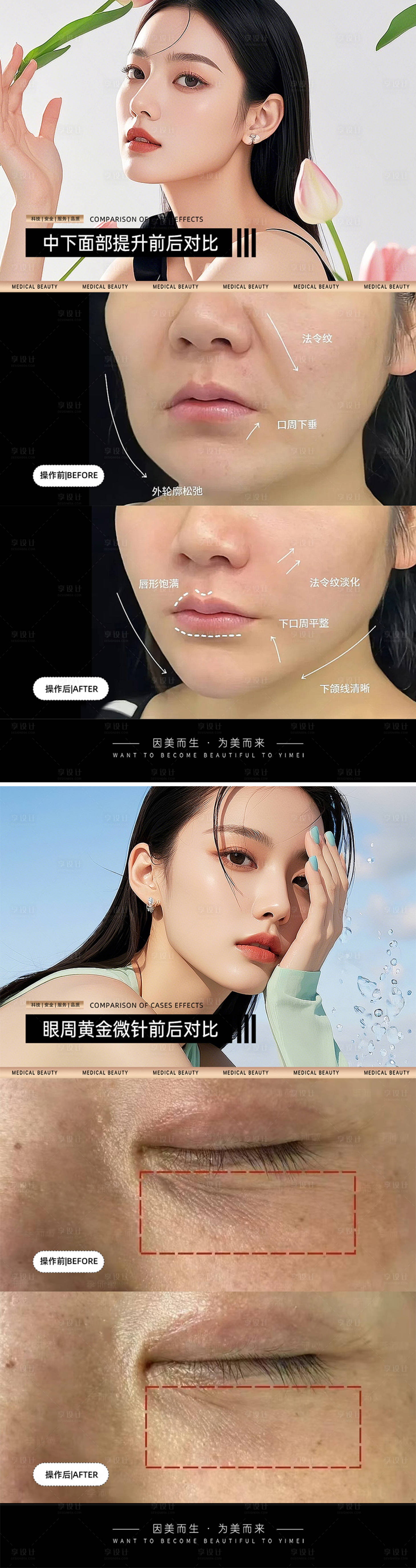 源文件下载【享设计】搜索编号：51920032590539869【医美案例对比模板】