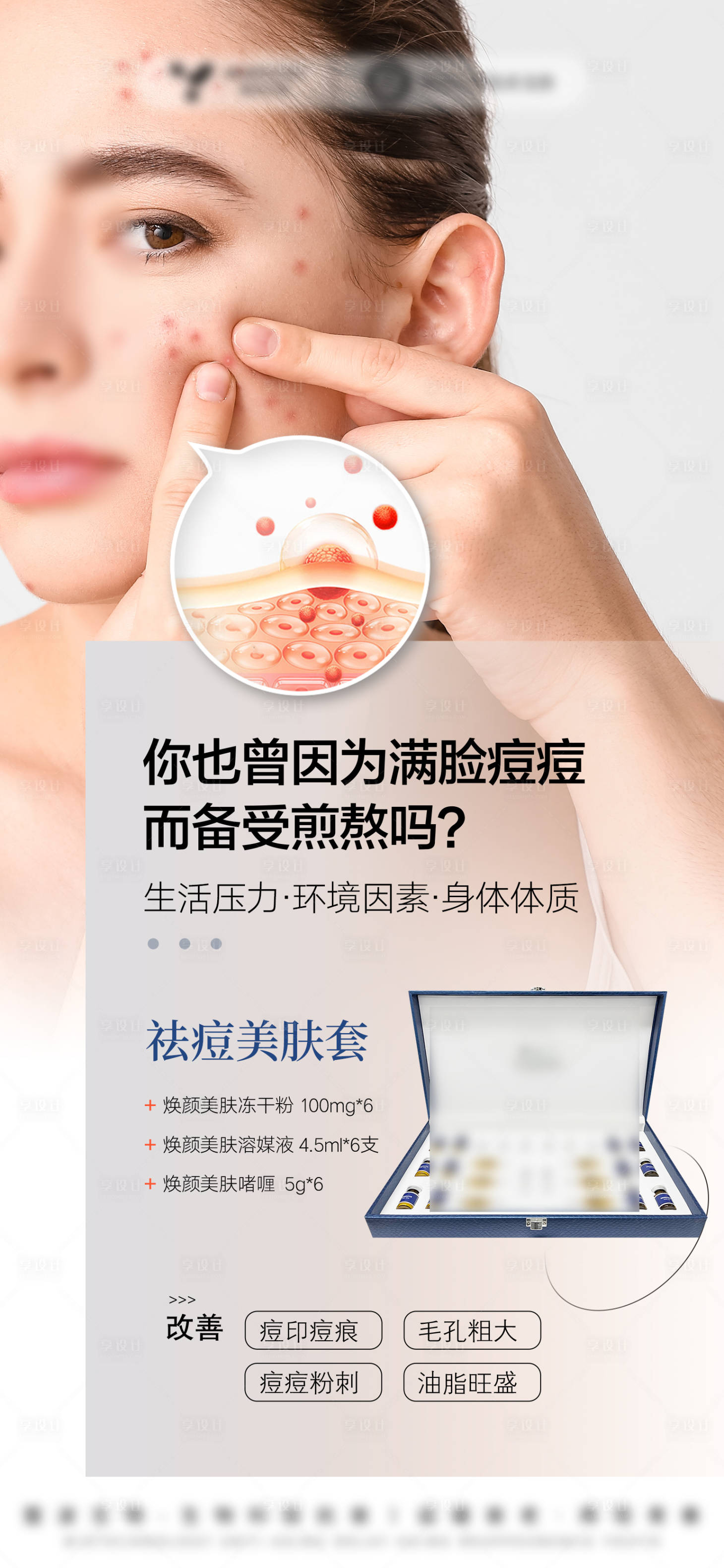源文件下载【享设计】搜索编号：43920032659241017【医美美业护肤品祛痘套盒海报】