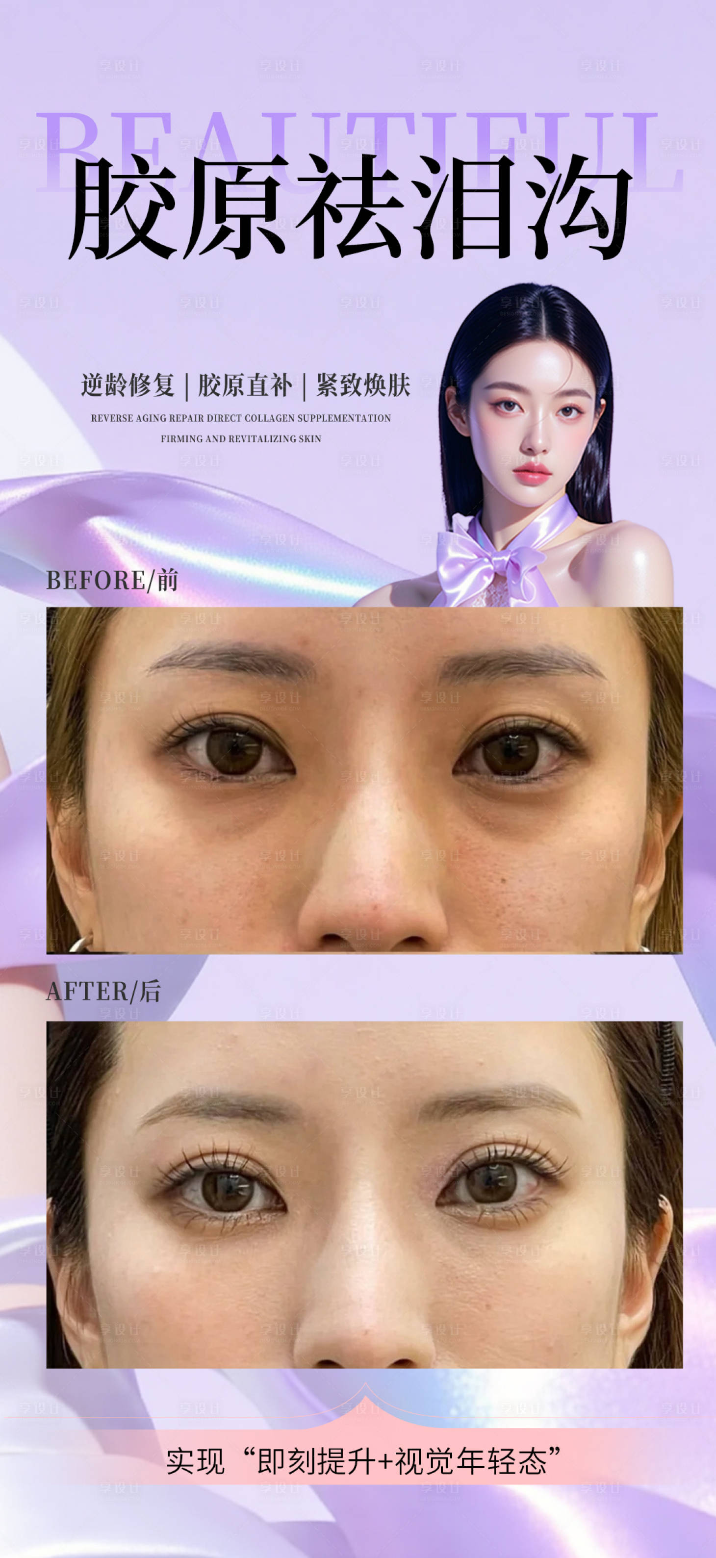 源文件下载【享设计】搜索编号：71530032497685894【胶原去泪沟】