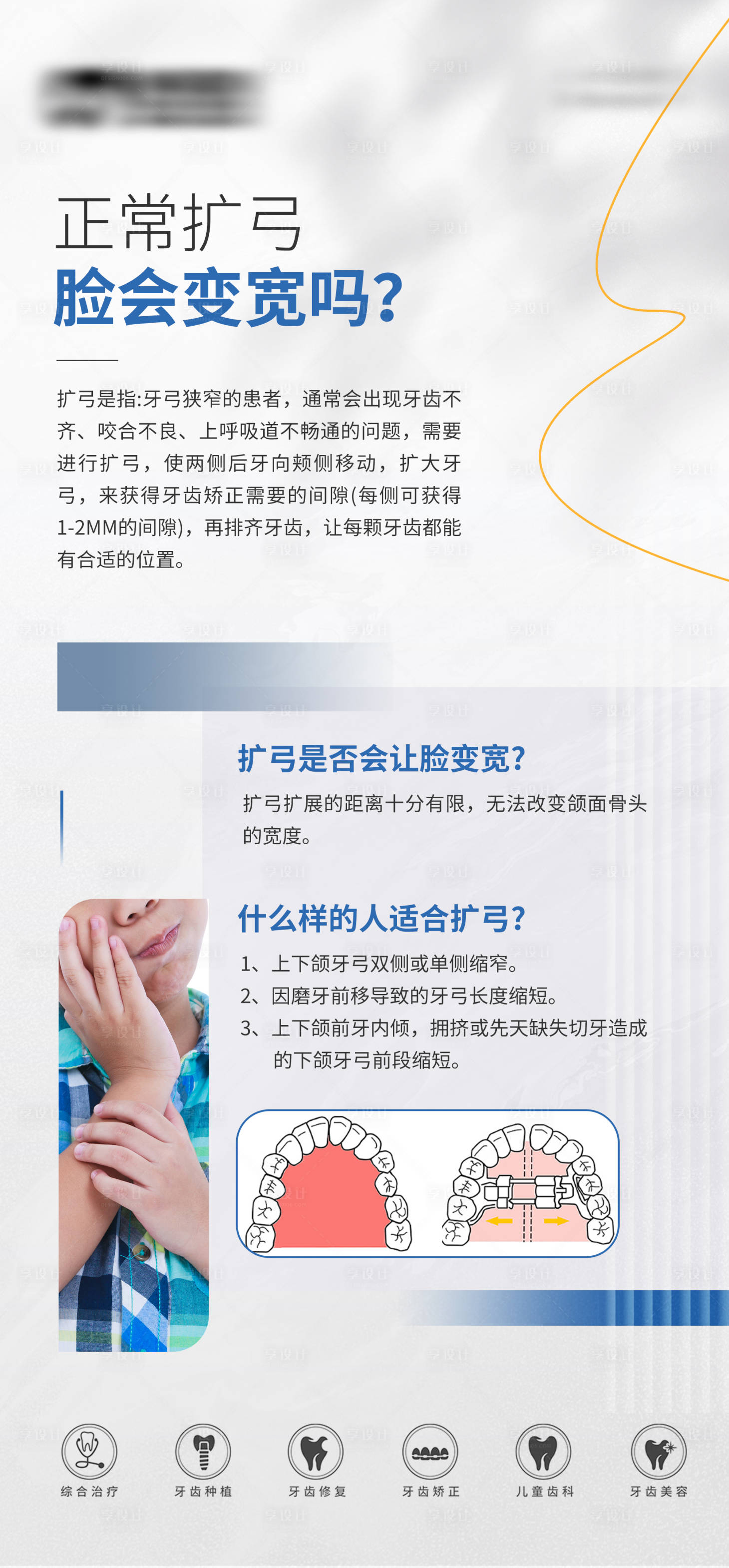 源文件下載【享設計】搜索編號：41410032741318092【牙齒矯正擴弓科普】