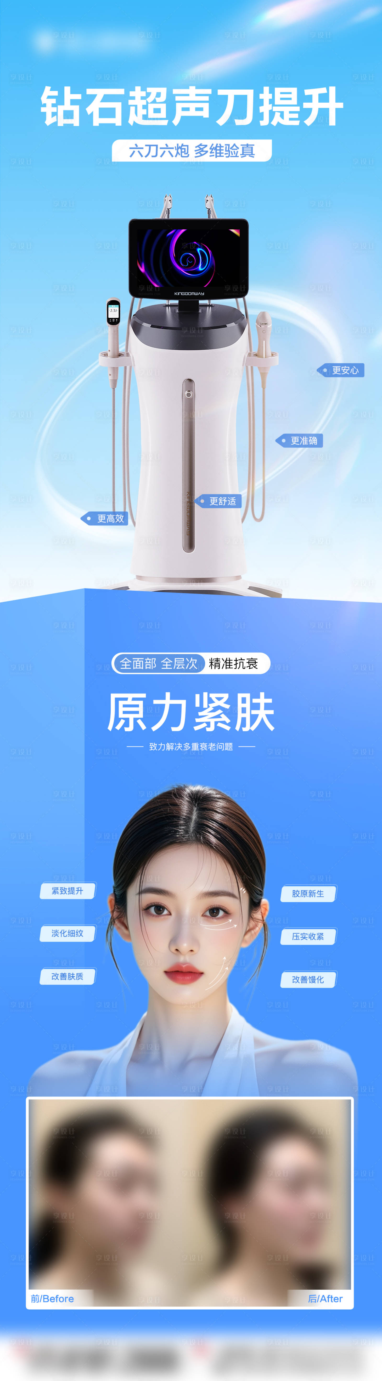 源文件下载【享设计】搜索编号：47720032619923523【超声刀仪器】