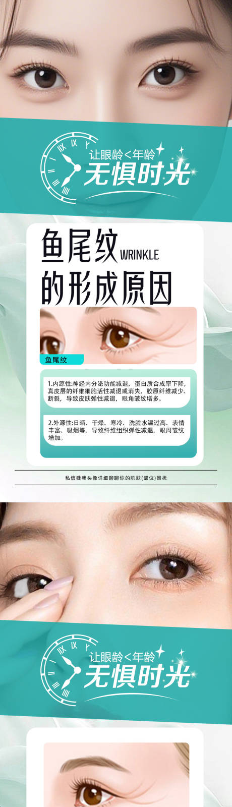 源文件下載【享設計】搜索編號：29650032485147495【眼尾紋】