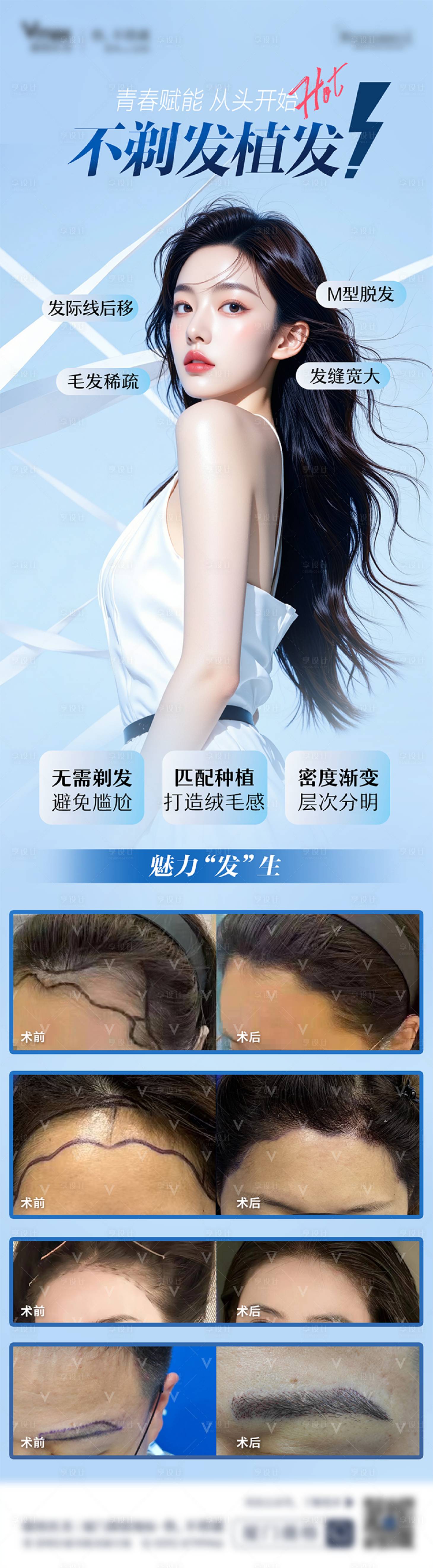 源文件下载【享设计】搜索编号：41690032589386846【医美无痕植发案例海报宣传活动】