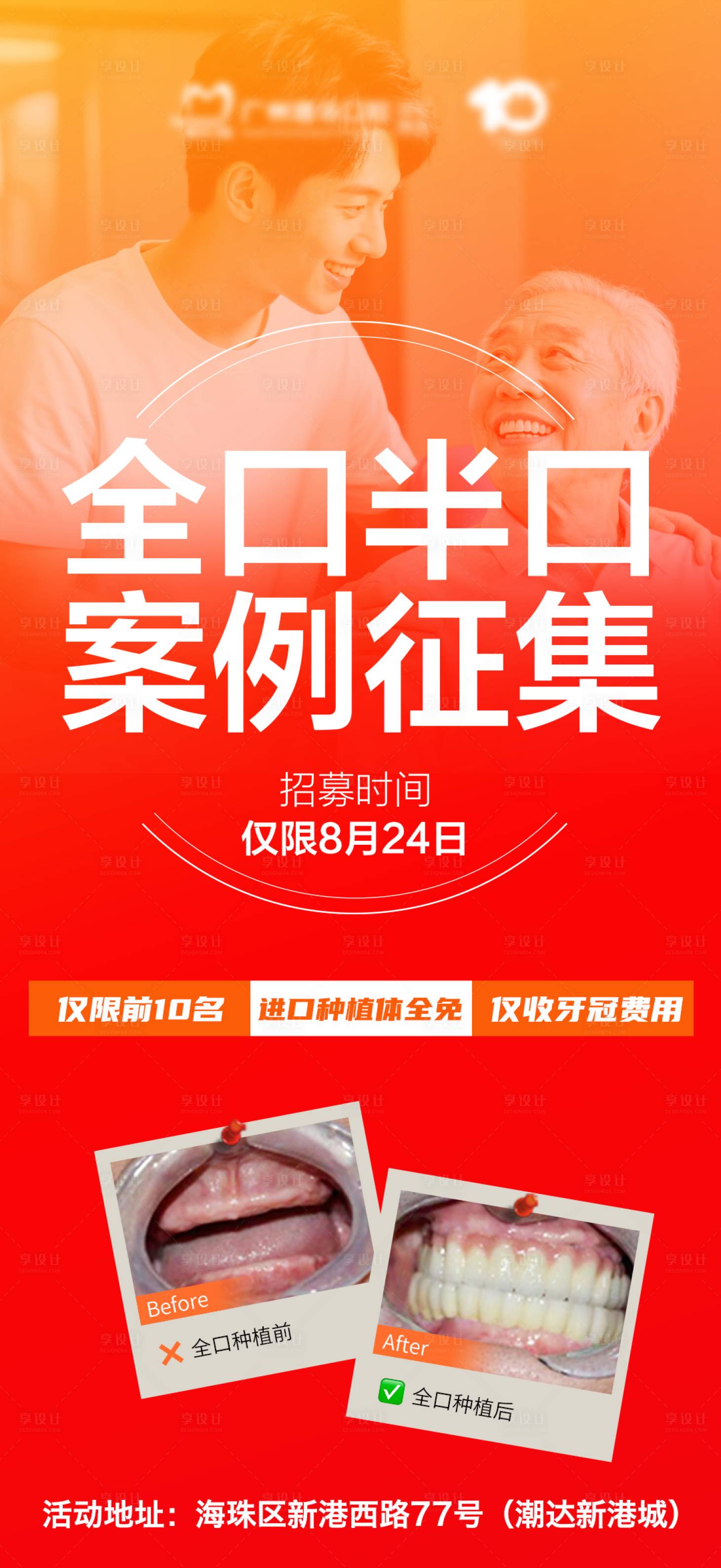 源文件下载【享设计】搜索编号：43910032575647596【口腔全口半口案例征集】