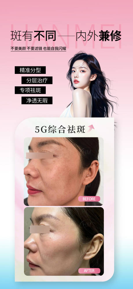 源文件下載【享設(shè)計(jì)】搜索編號(hào)：54650032435385738【祛斑案例】