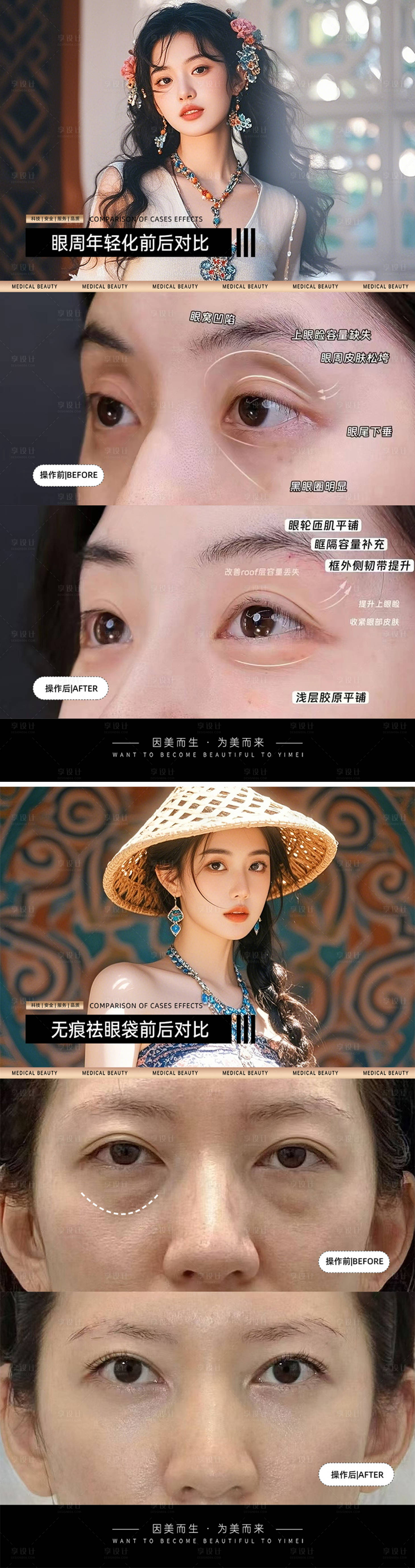 源文件下载【享设计】搜索编号：40600032526857758【医美案例对比模板】