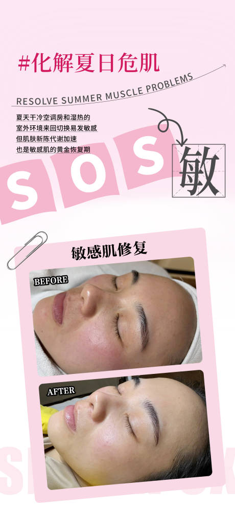 源文件下载【享设计】搜索编号：40690032329827413【敏感肌修复海报】