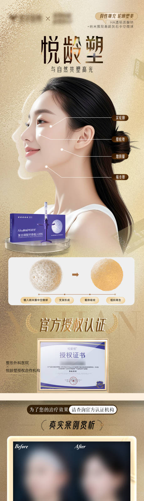 源文件下載【享設計】搜索編號：59970032530995643【悅齡塑授權認證案例對比圖】