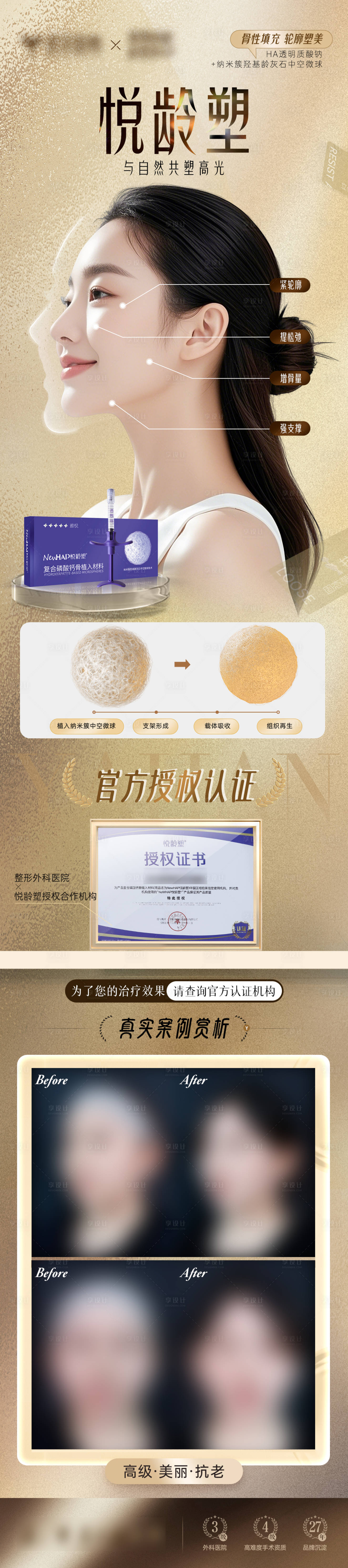 源文件下载【享设计】搜索编号：59970032530995643【悦龄塑授权认证案例对比图】
