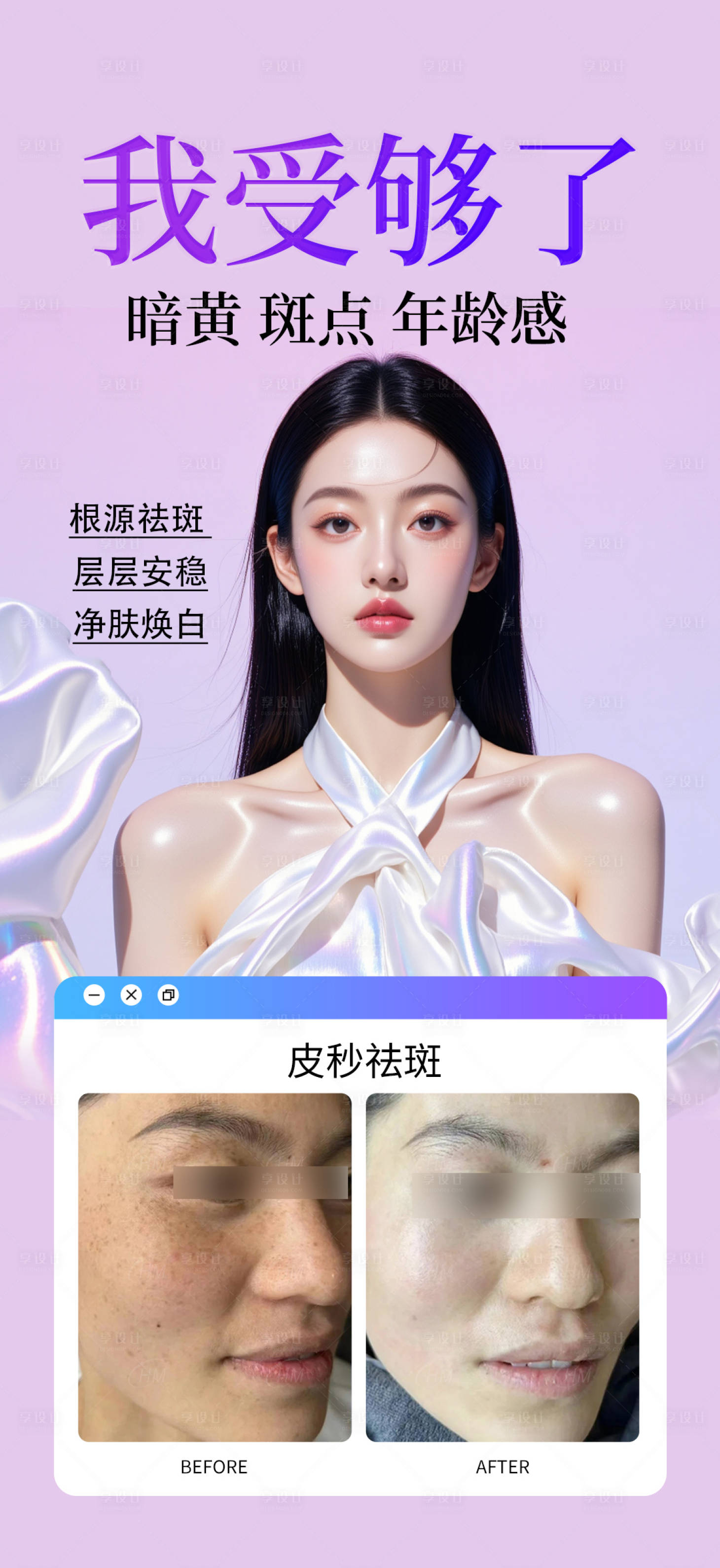 源文件下载【医美皮秒祛斑案例】编号：47770032284912029