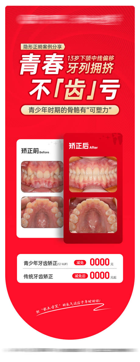 源文件下载【享设计】搜索编号：66570032798055167【口腔案例海报】