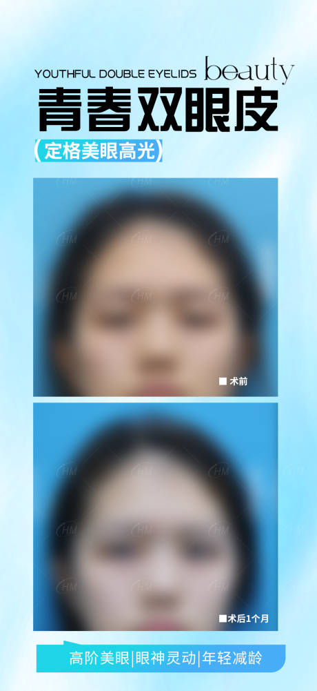 源文件下載【享設計】搜索編號：85080032367032114【青春雙眼皮海報】