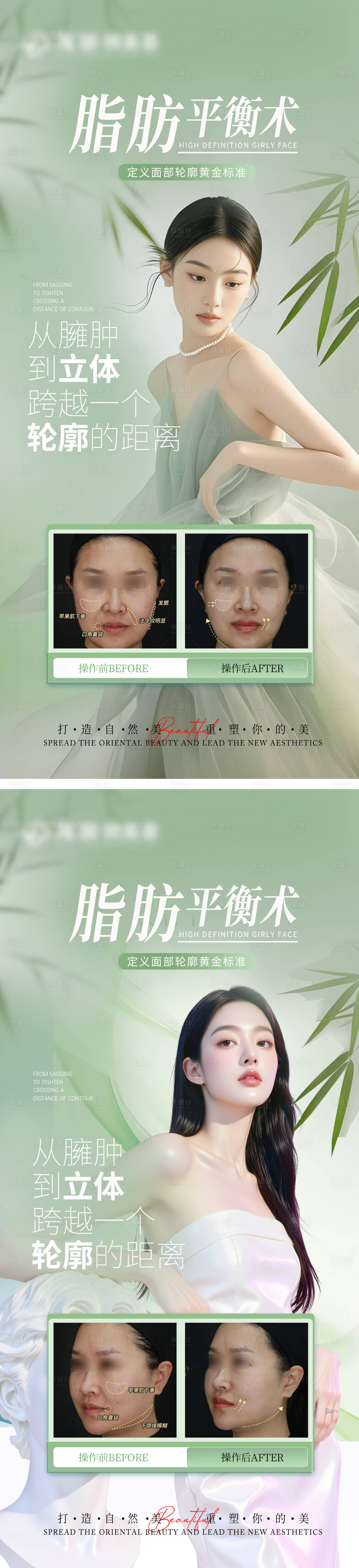 源文件下载【享设计】搜索编号：46180032317441594【医美祛馒化宣传对比海报】