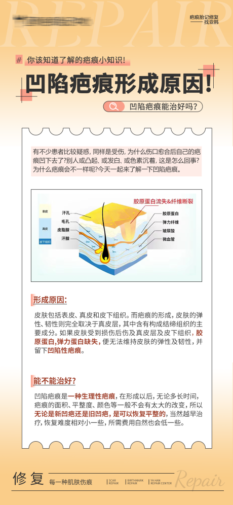 源文件下載【享設計】搜索編號：31220032436409076【凹陷疤痕形成原因】