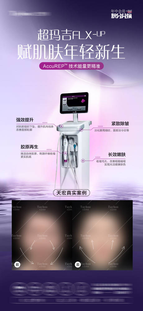 源文件下载【享设计】搜索编号：54010032418131497【热玛吉仪器海报】
