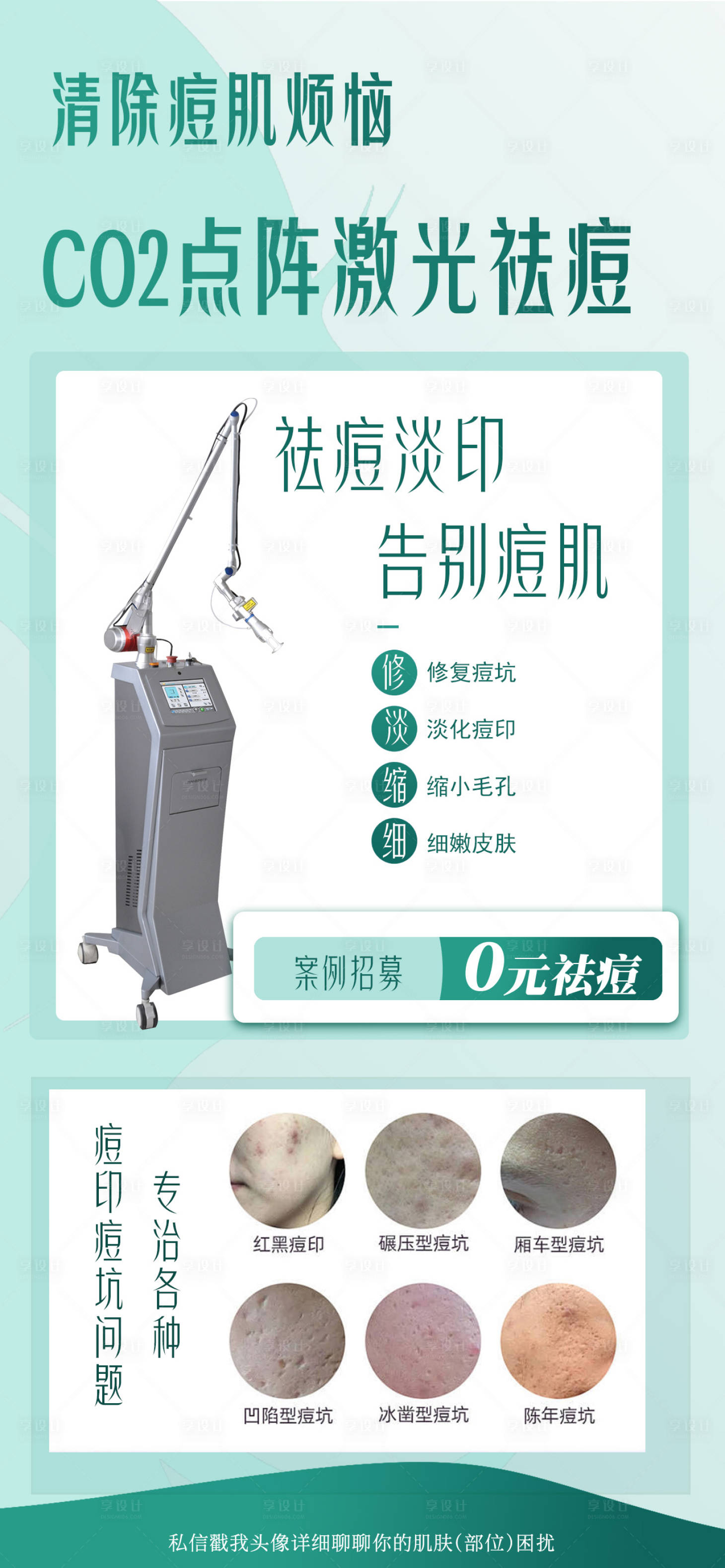 源文件下載【享設計】搜索編號：21650032478767877【點陣激光祛痘】
