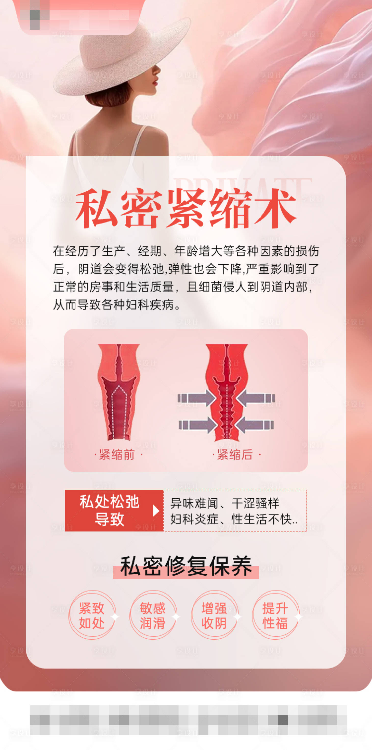 源文件下载【享设计】搜索编号：16590032296445655【私密紧缩术】