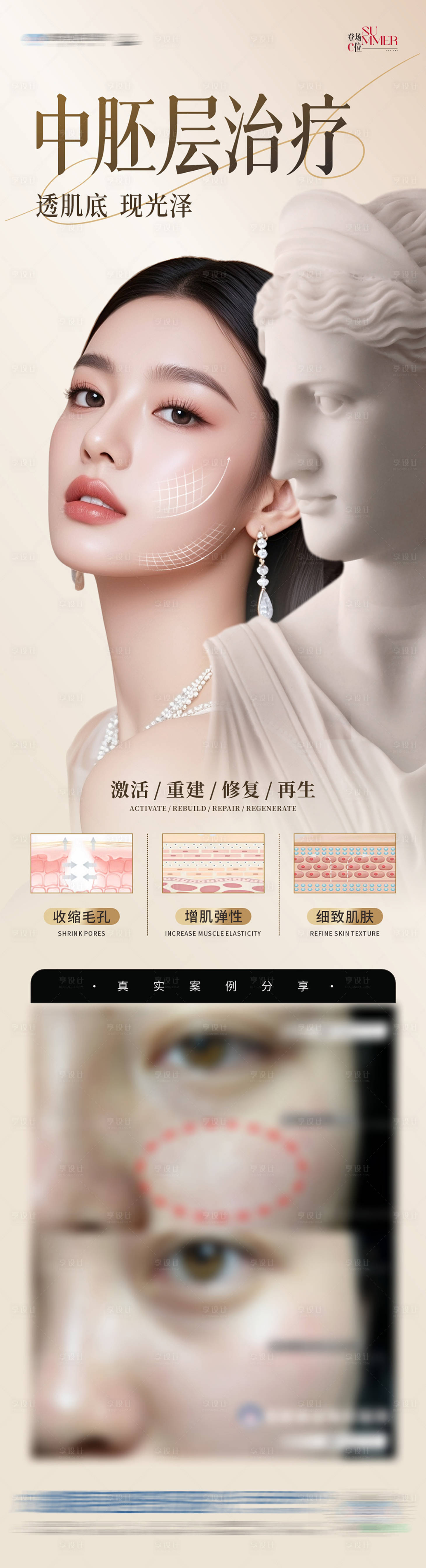 源文件下載【享設計】搜索編號：13330032547574185【醫美中胚層治療肌膚修復再生案例創意海】