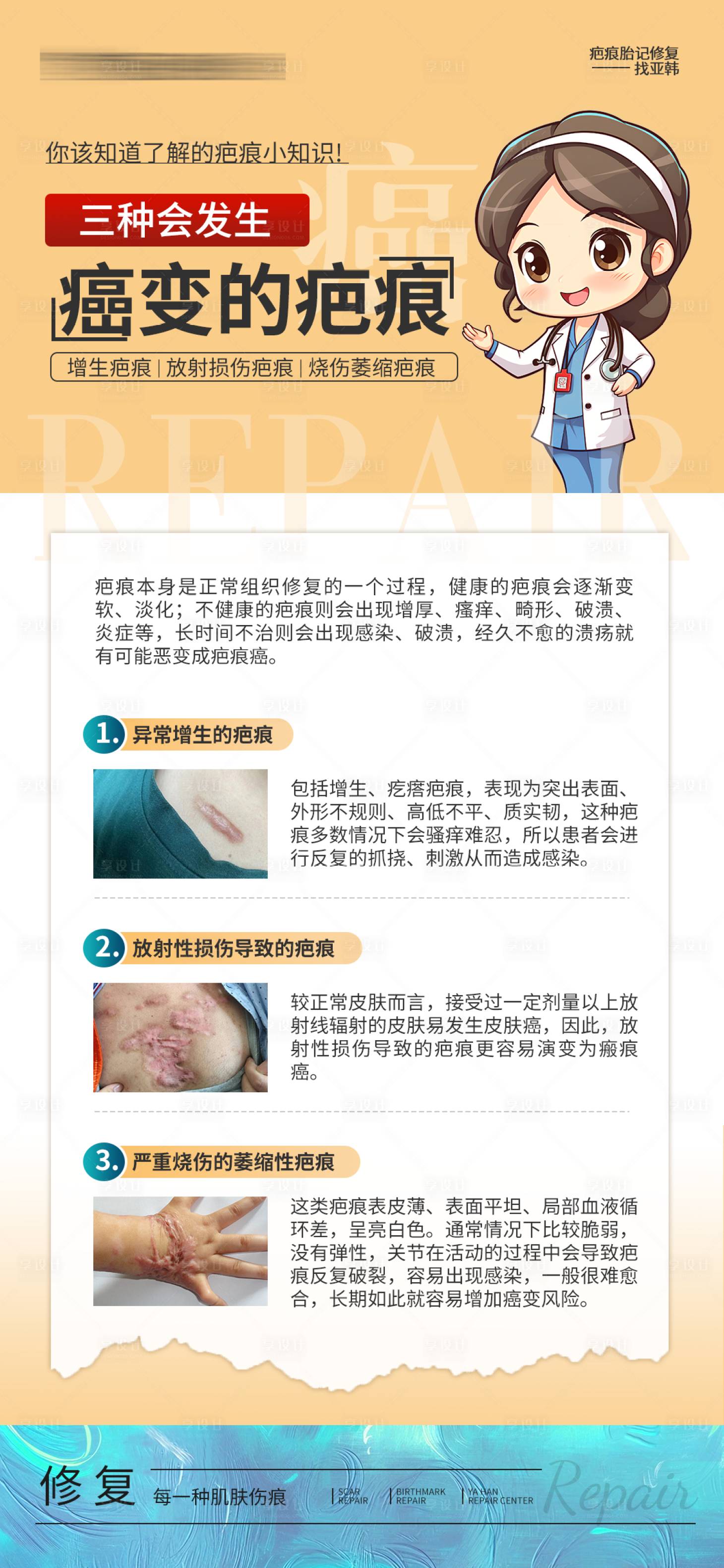 源文件下载【享设计】搜索编号：52260032734255421【三种会发生癌变的疤痕海报】