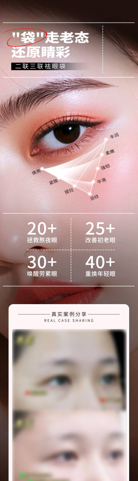 源文件下載【享設(shè)計(jì)】搜索編號(hào)：30480032508247465【醫(yī)美二聯(lián)三聯(lián)祛眼袋年輕化案例創(chuàng)意海報(bào)】
