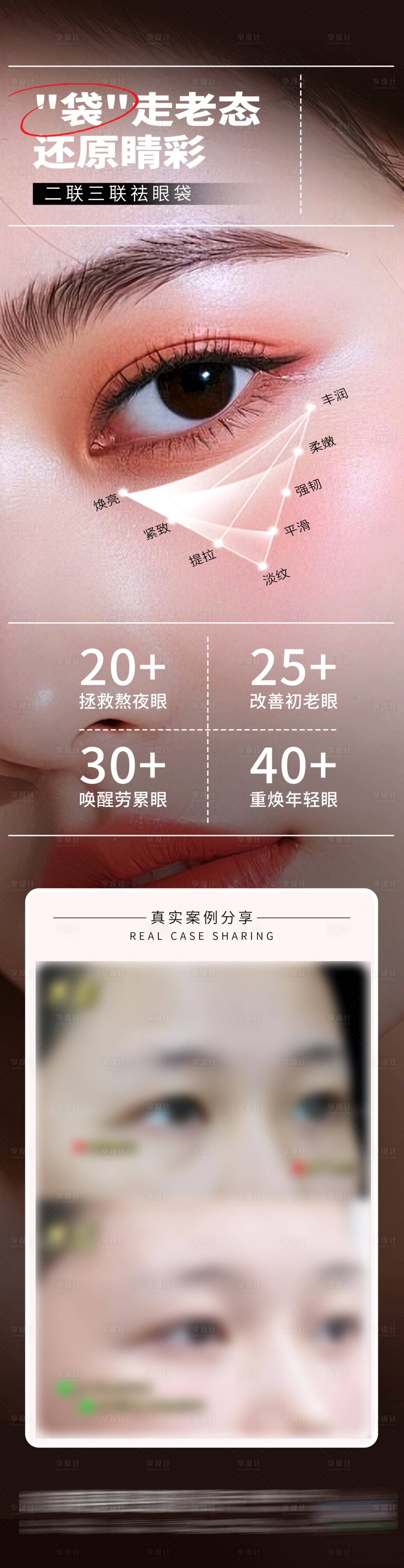 源文件下载【享设计】搜索编号：30480032508247465【医美二联三联祛眼袋年轻化案例创意海报】