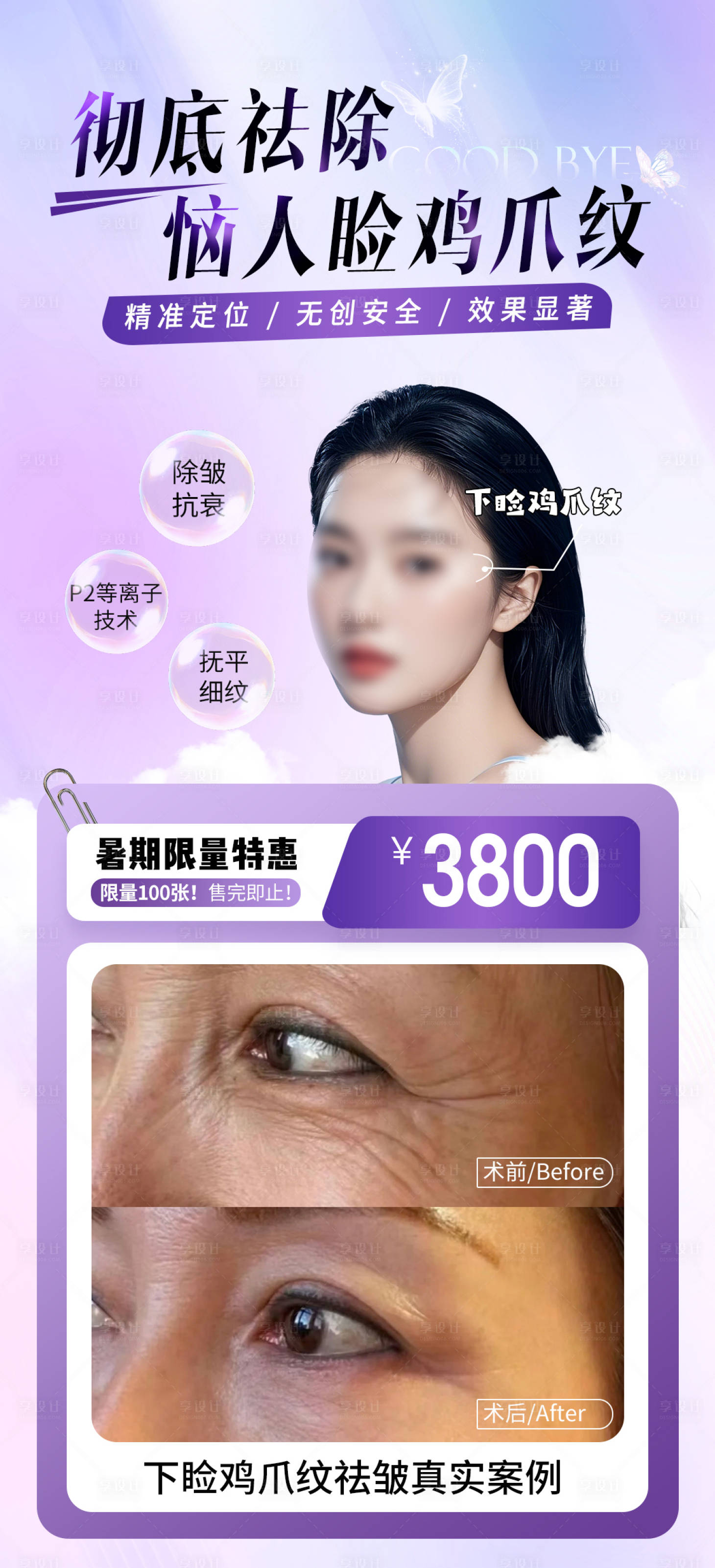 源文件下载【享设计】搜索编号：49510032686453880【医美案例活动海报】