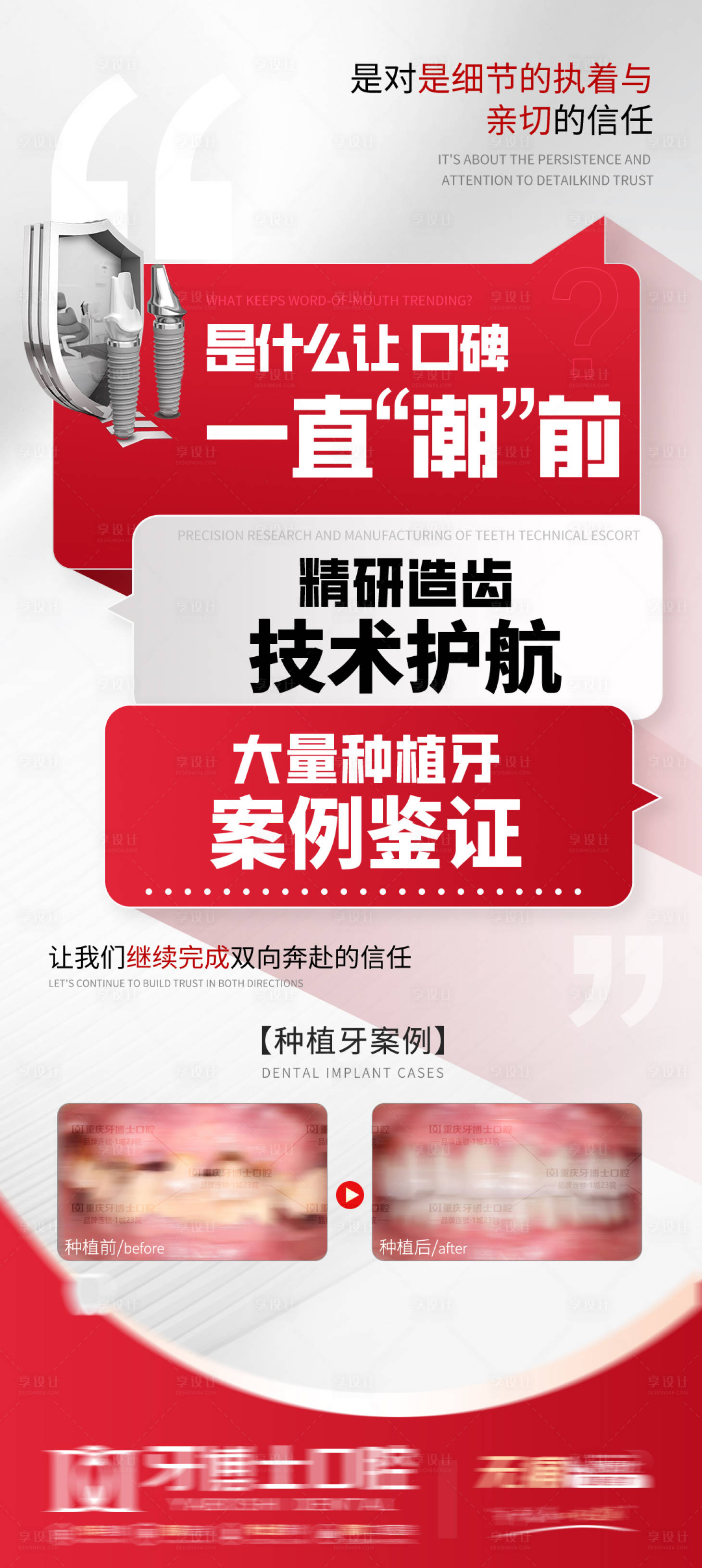 源文件下载【享设计】搜索编号：39190032743108721【种植牙口腔科普海报】
