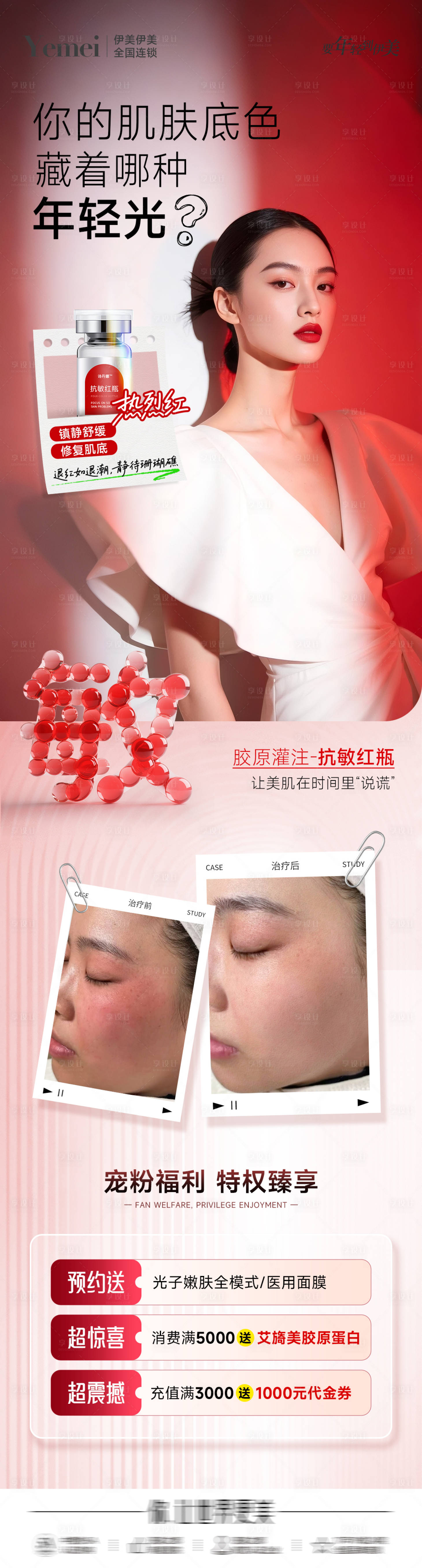 源文件下载【享设计】搜索编号：43960032607896182【医美抗敏案例长图】
