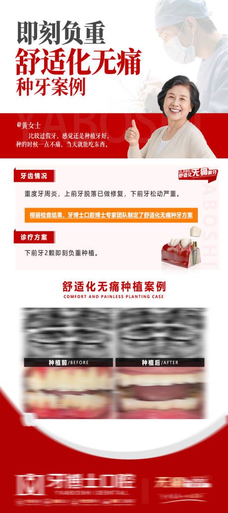 源文件下載【享設計】搜索編號：14150032591129719【舒適化口腔診療種牙海報】