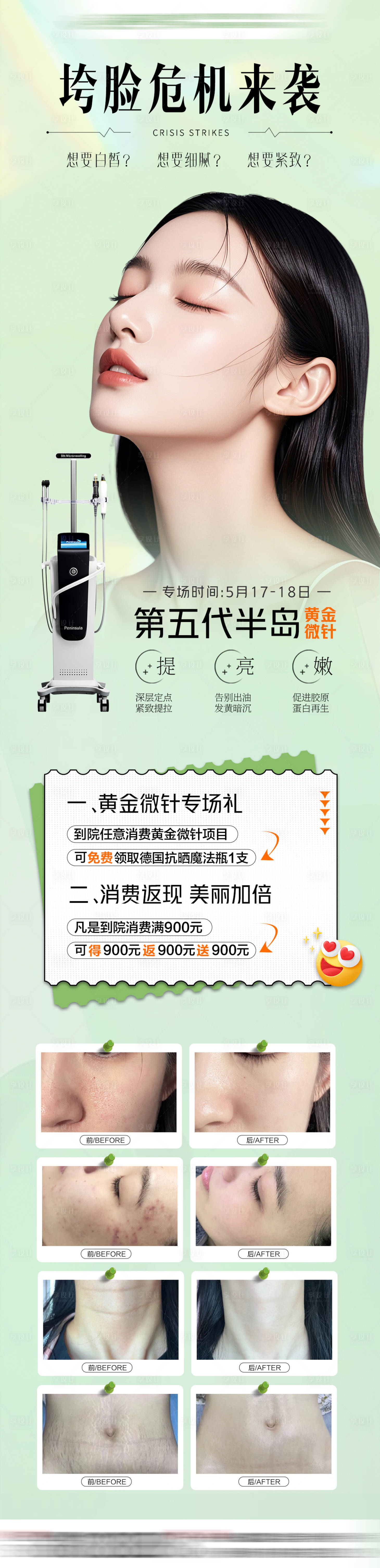 源文件下載【享設(shè)計】搜索編號：50120032635873361【半島黃金微針專場海報】