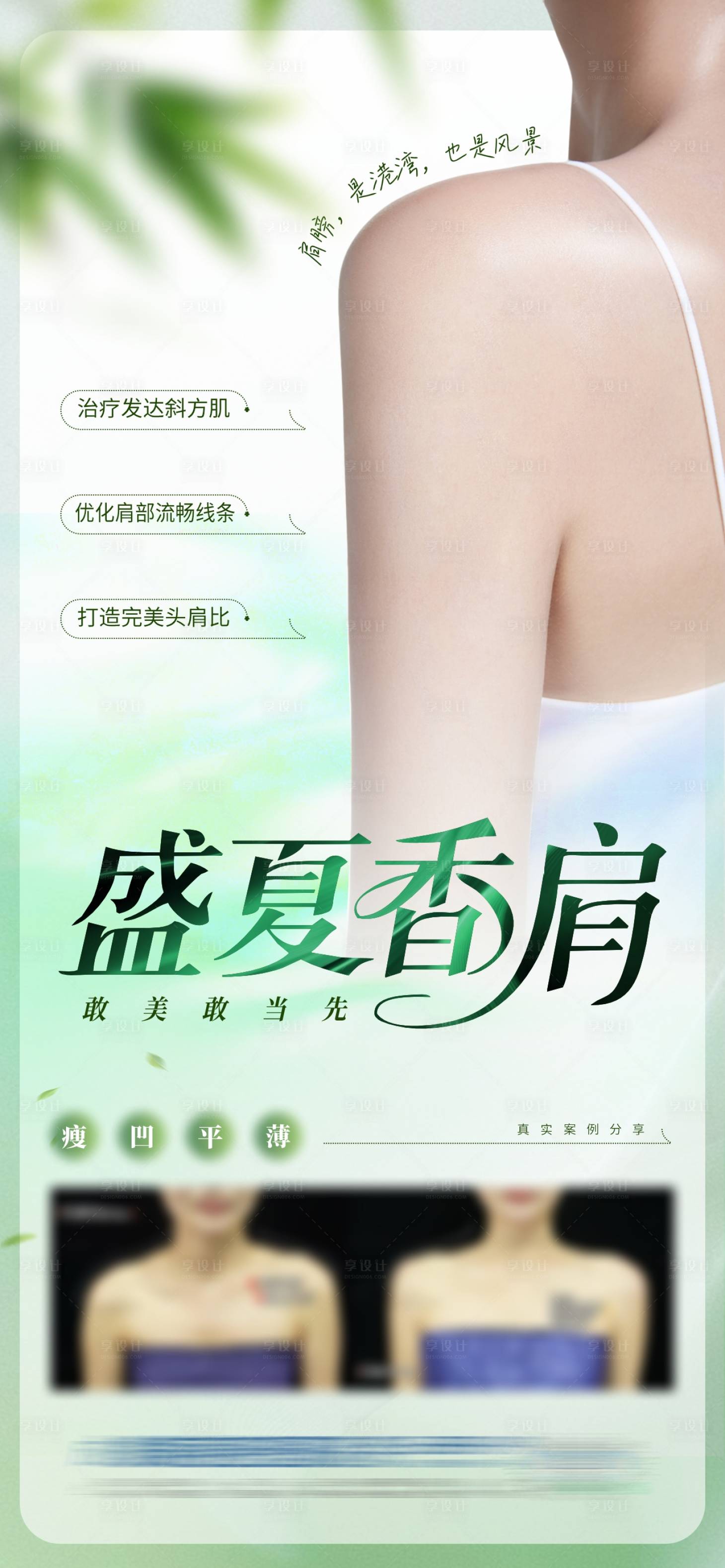 源文件下載【享設計】搜索編號：53420032427855767【醫美直角肩肩膀整形案例創意海報】