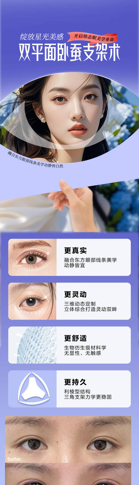 源文件下載【享設計】搜索編號：32390032491424731【雙平面臥蠶支架術】