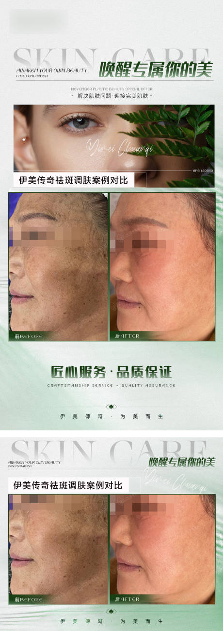 源文件下载【享设计】搜索编号：36800032798585217【轻医美对比海模板】