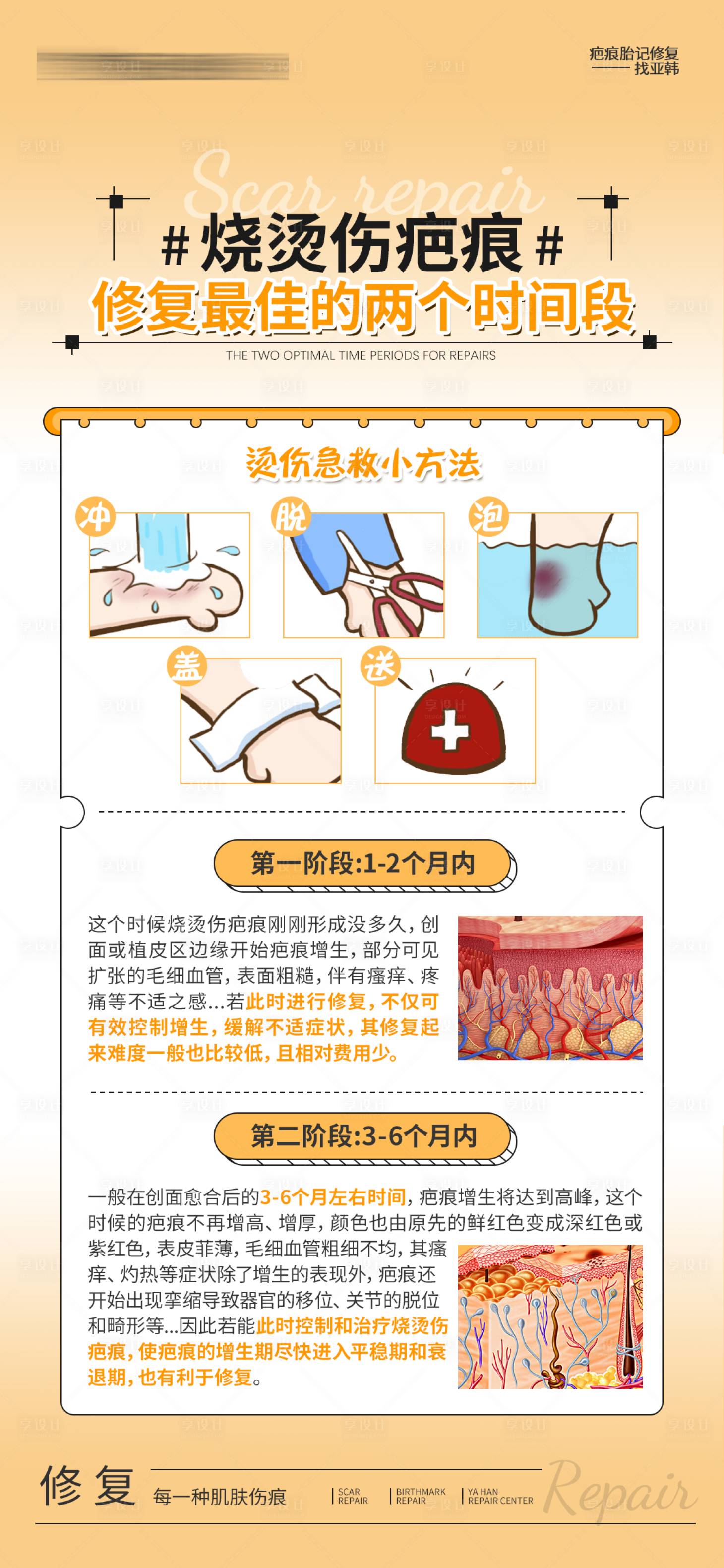 源文件下载【享设计】搜索编号：45400032734243972【烧烫伤疤最佳治疗时间海报】