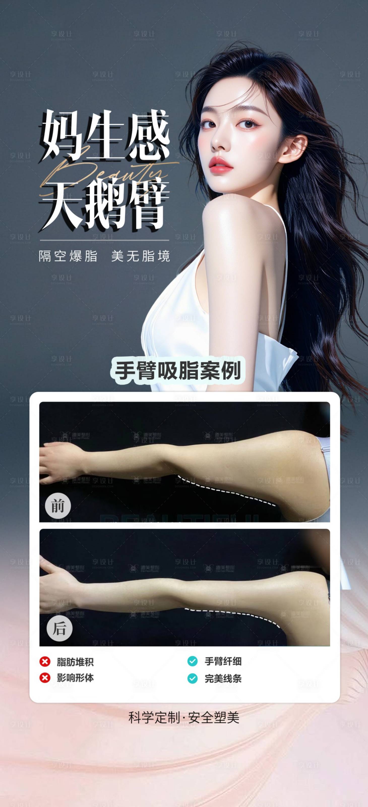 源文件下载【享设计】搜索编号：96430032428098523【手臂吸脂案例】