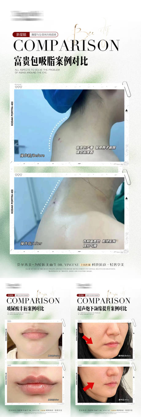 源文件下载【享设计】搜索编号：58340032353663464【微整案例】