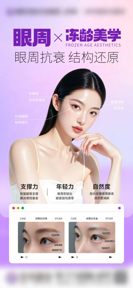 源文件下載【享設計】搜索編號：23860032414298412【眼周抗衰 】