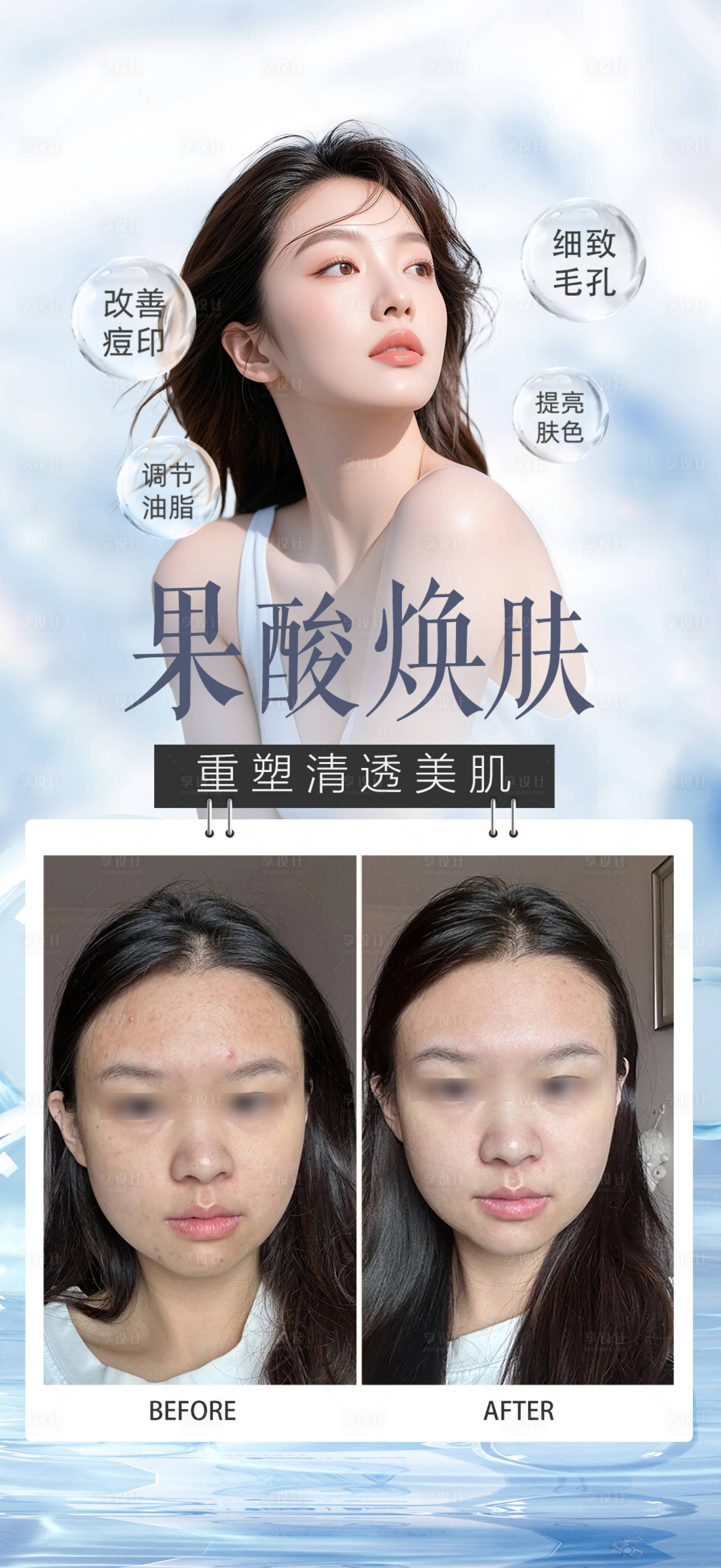 源文件下載【享設計】搜索編號：97650032486426678【果酸煥膚案例】