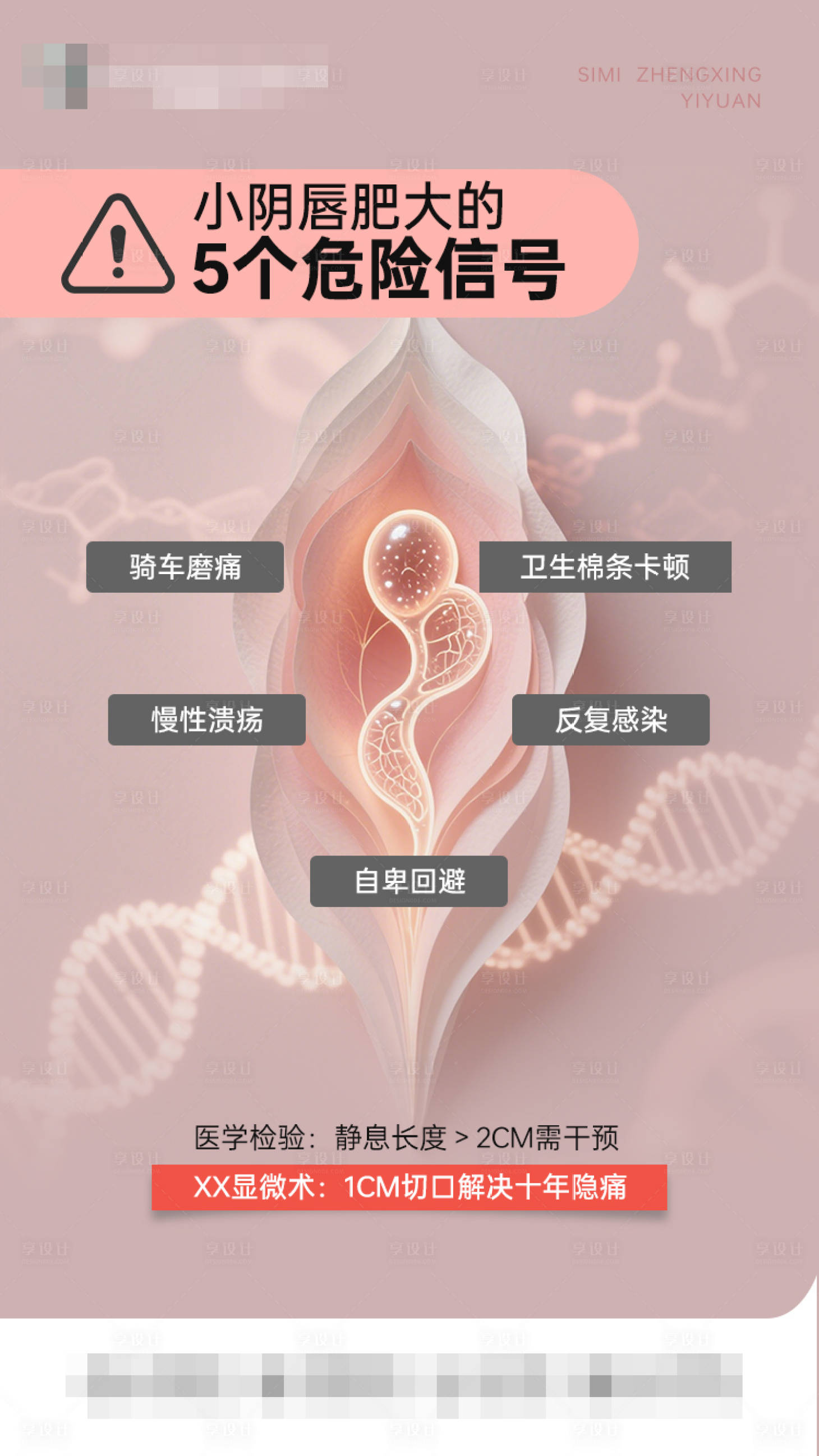 源文件下载【享设计】搜索编号：17760032405676133【小阴唇肥大的5个危险信号！】