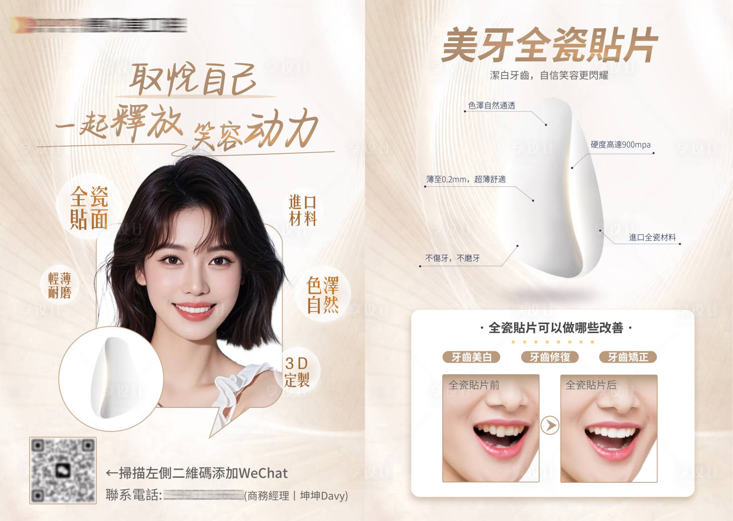 源文件下載【享設計】搜索編號：33920032435778976【美牙全瓷貼片A4宣傳單】