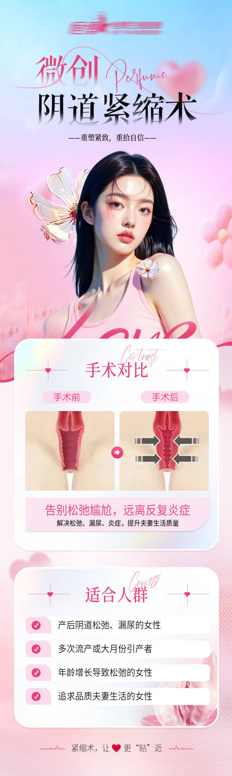 源文件下载【享设计】搜索编号：91150032393415350【微创阴道紧缩术私密海报】