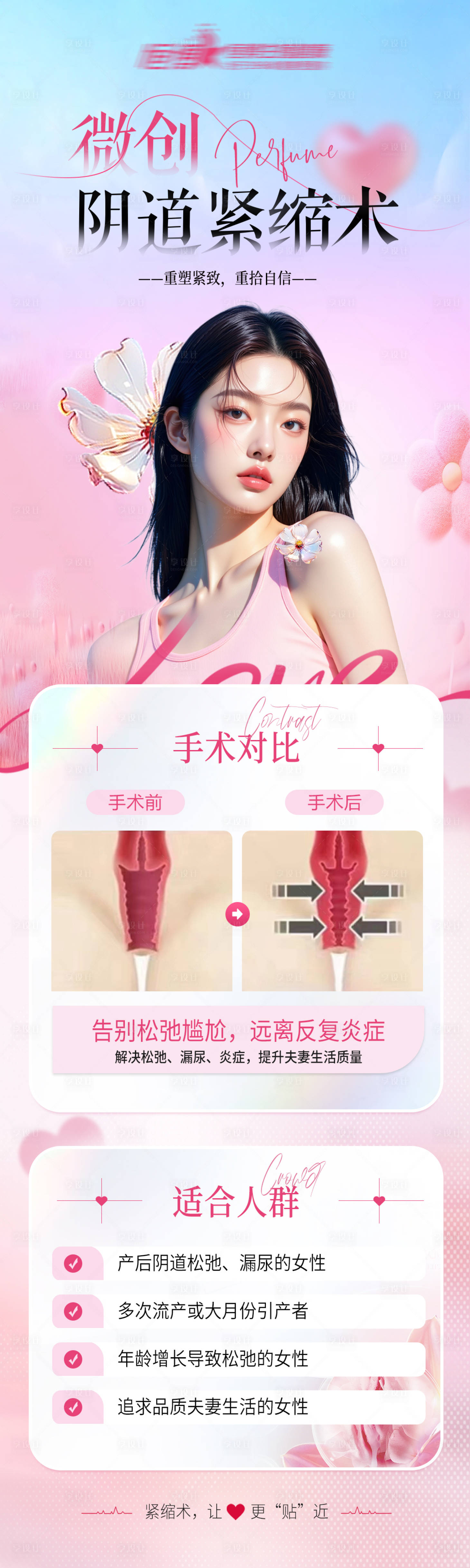 源文件下載【享設(shè)計(jì)】搜索編號(hào)：91150032393415350【微創(chuàng)陰道緊縮術(shù)私密海報(bào)】