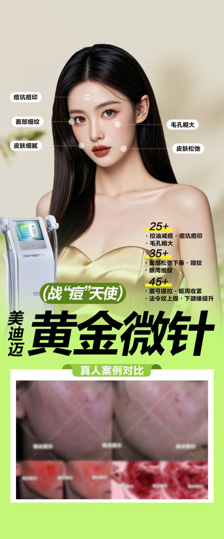 源文件下載【享設(shè)計】搜索編號：25650032276336015【戰(zhàn)痘天使美迪邁黃金微針】
