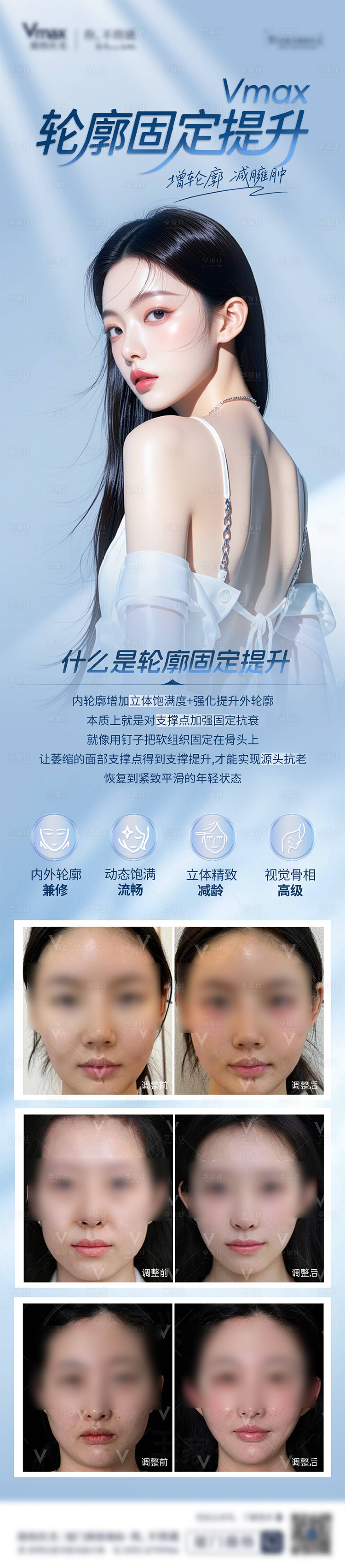 源文件下載【享設計】搜索編號：89090032813897271【醫美輪廓固定提升韌帶案例長圖海報】