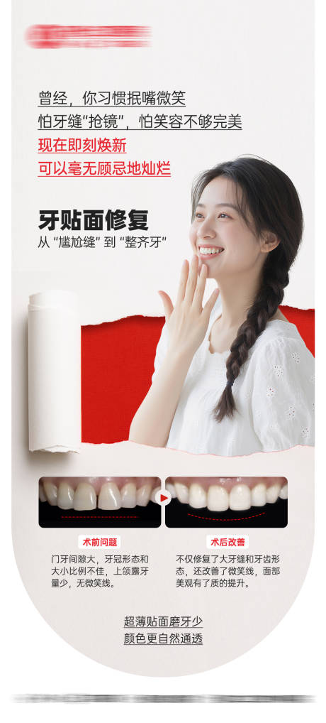 源文件下载【享设计】搜索编号：25230032762724212【牙贴面修复整牙口腔海报】