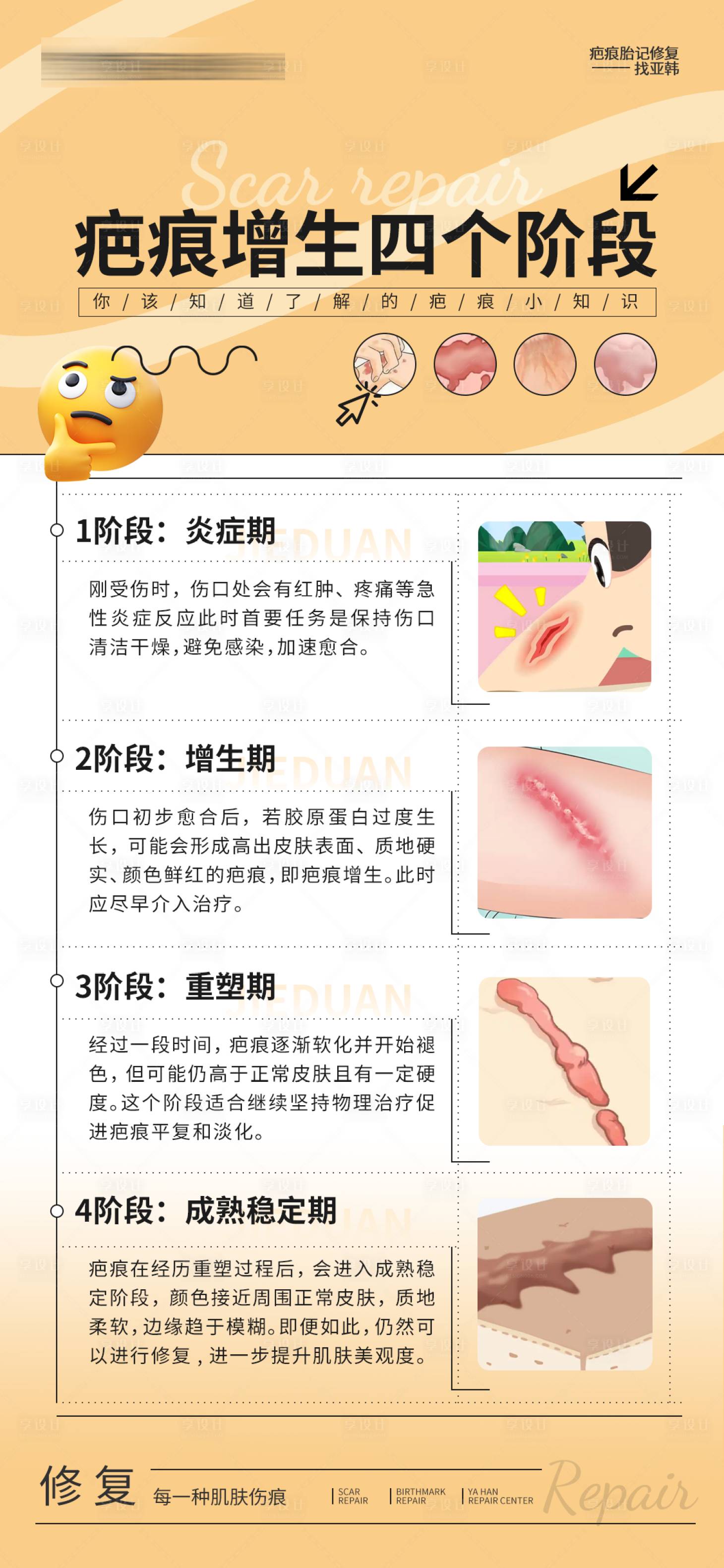 源文件下载【享设计】搜索编号：66930032733962816【疤痕增生四个阶段海报】