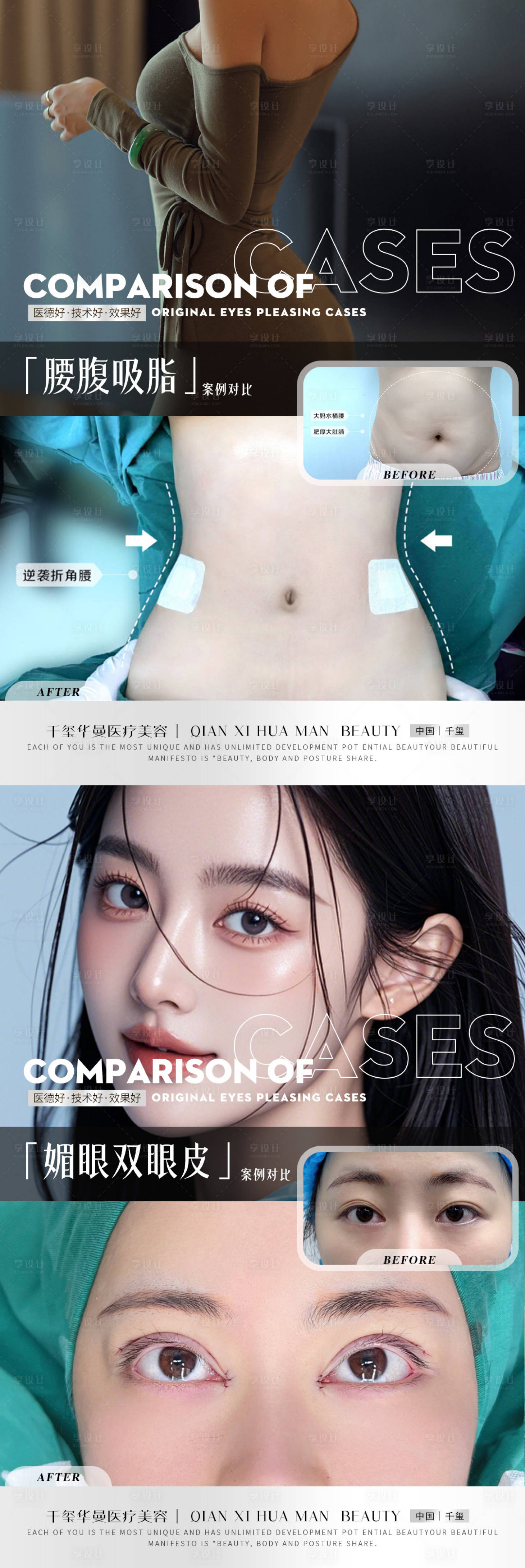 源文件下載【享設計】搜索編號：35950032462029341【高級整形案例】