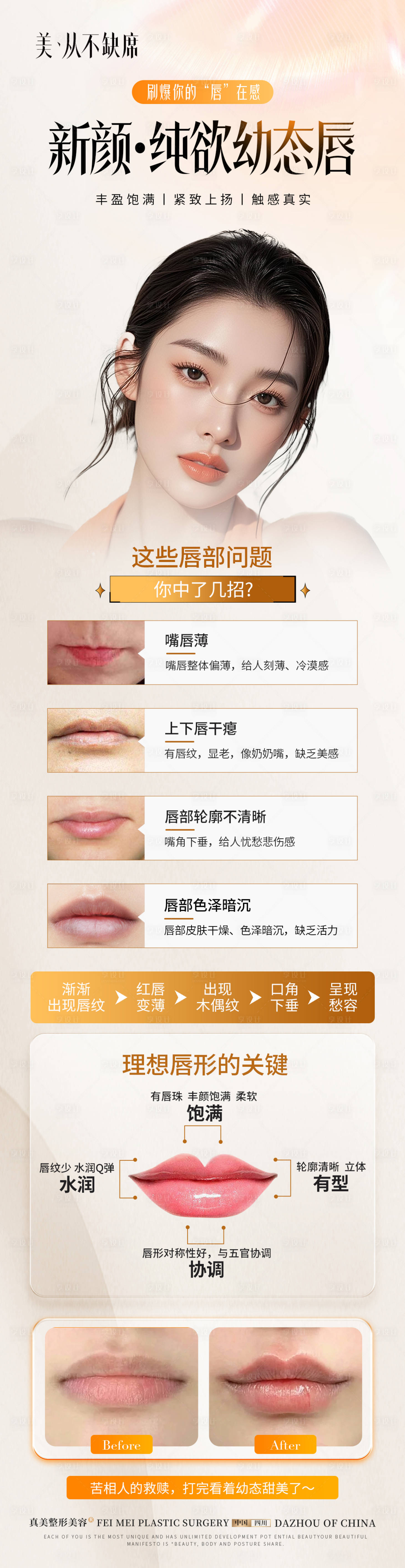 源文件下載【享設計】搜索編號：23560032780453235【醫美豐唇案例科普長圖海報】
